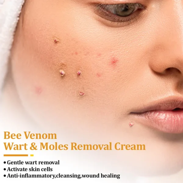 Newyuo™ TagCure Bee Venom Cream