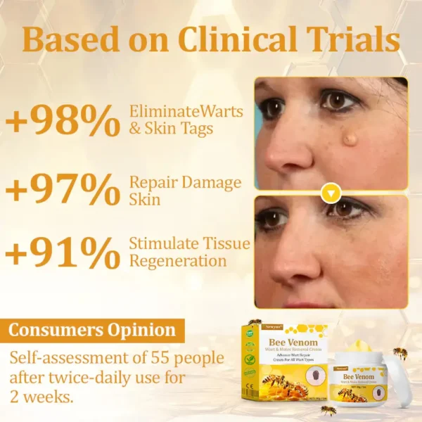 Newyuo™ TagCure Bee Venom Cream