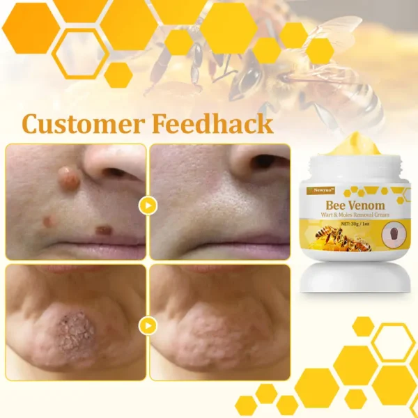 Newyuo™ TagCure Bee Venom Cream