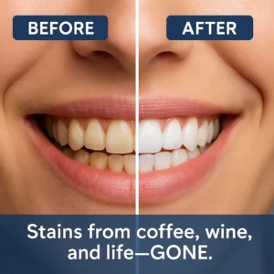 🏆【Max】 Newyuo® Nicotinamide Toothpaste【💎New upgrade Powerful type 10% concentration of Nicotinamide】