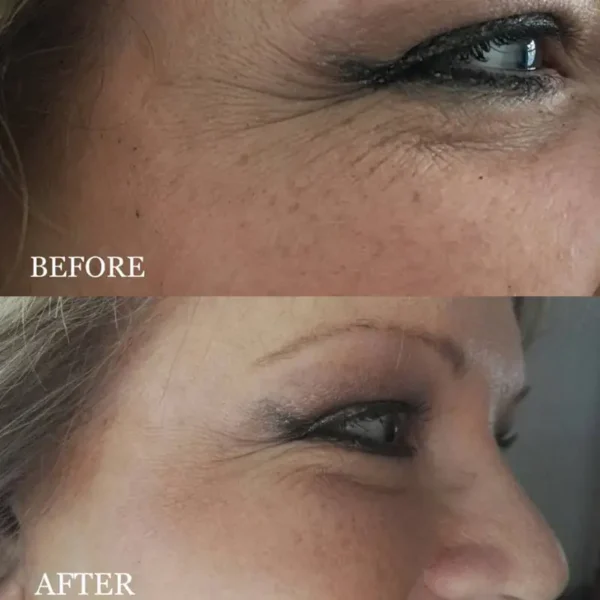 Newyuo™ Collagen Facial & Neck Sheet Mask