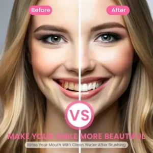 🏆【Max】 Newyuo® Nicotinamide Toothpaste【💎New upgrade Powerful type 10% concentration of Nicotinamide】