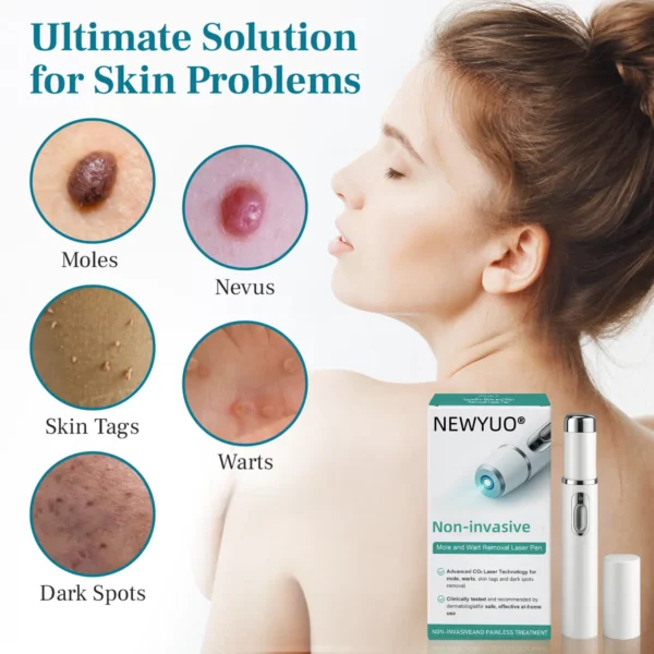 NEWYUO® Non-invasive Mole and Wart Removal Laser Pen 🟢1