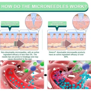 [🧘🏼Naturally shape your body]💎 Newyuo® 5-in-1 GLP-1 NANO MICRONEEDLE PATCHES（Zero Pain, 24/7 Release | Lose 20lbs FAST | 90% Sugar Drop | ）