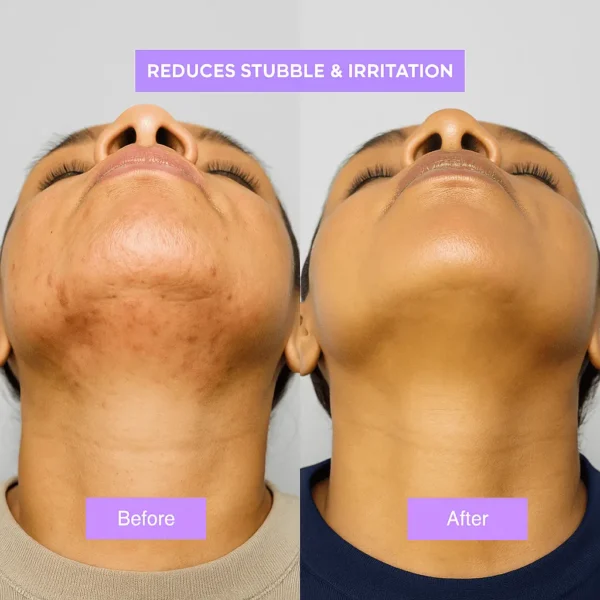 Newyuo™ - A Gentle Therapy for Your Body's Changing Needs