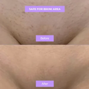 Newyuo™ - A Gentle Therapy for Your Body's Changing Needs