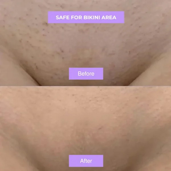 Newyuo™ - A Gentle Therapy for Your Body's Changing Needs