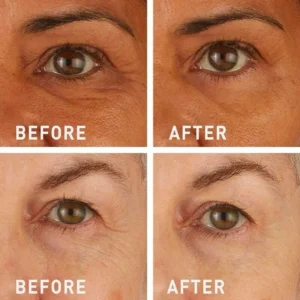 Newyuo™ Eye Lift in 60 Seconds – Smooth, Tighten, Brighten