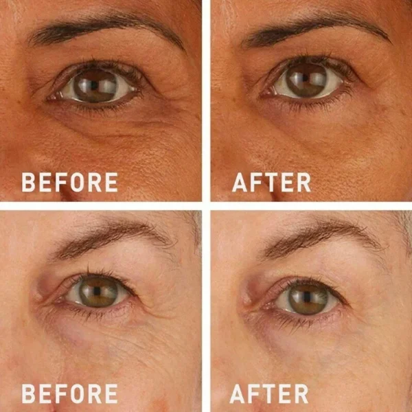 Newyuo™ Eye Lift in 60 Seconds – Smooth, Tighten, Brighten
