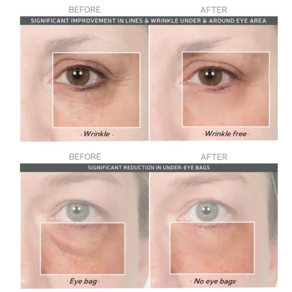 Newyuo™ Eye Lift in 60 Seconds – Smooth, Tighten, Brighten
