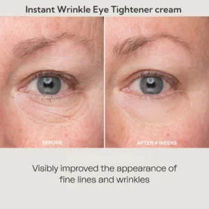 Newyuo™ Eye Lift in 60 Seconds – Smooth, Tighten, Brighten