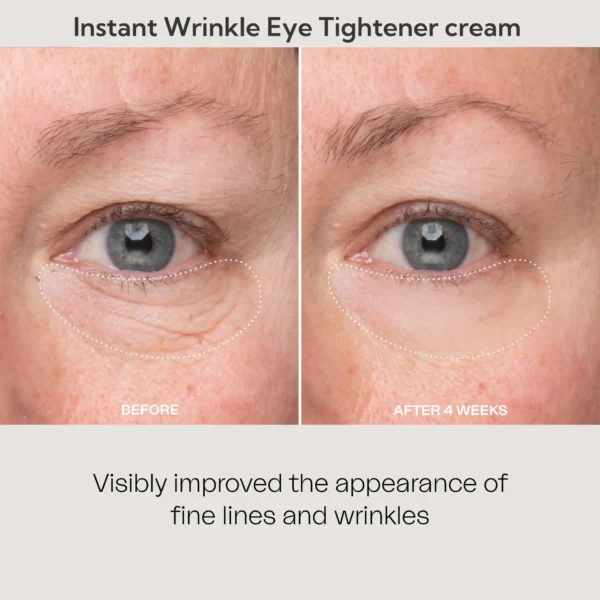 Newyuo™ Eye Lift in 60 Seconds – Smooth, Tighten, Brighten