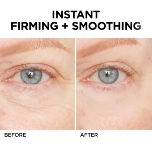 Newyuo™ Eye Lift in 60 Seconds – Smooth, Tighten, Brighten