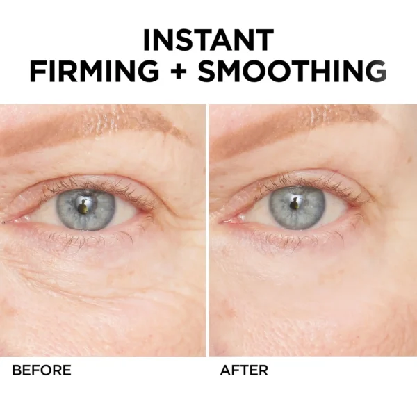 Newyuo™ Eye Lift in 60 Seconds – Smooth, Tighten, Brighten