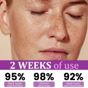 Newyuo® MelantraX Advanced Anti-Hyperpigmentation Essence