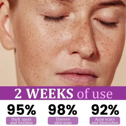 Newyuo® MelantraX Advanced Anti-Hyperpigmentation Essence