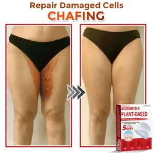 Newyuo® MicroNeedle Botanic Skin Tag Removal Patch