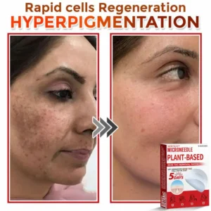 Newyuo® MicroNeedle Botanic Skin Tag Removal Patch