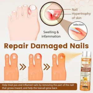 Newyuo™ NailRescue Bee Venom Nail Spray