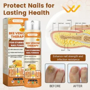 Newyuo™ NailRescue Bee Venom Nail Spray