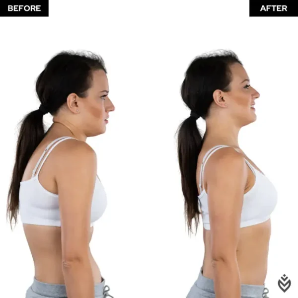 Newyuo® Posture Corrector