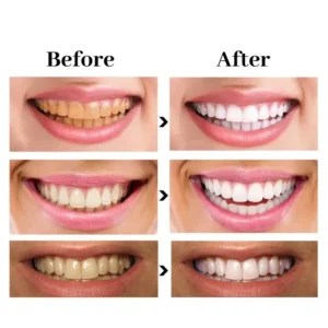 Newyuo™ Triple Whitening Toothpaste, Brightening & Stain Removal & Freshening Breath