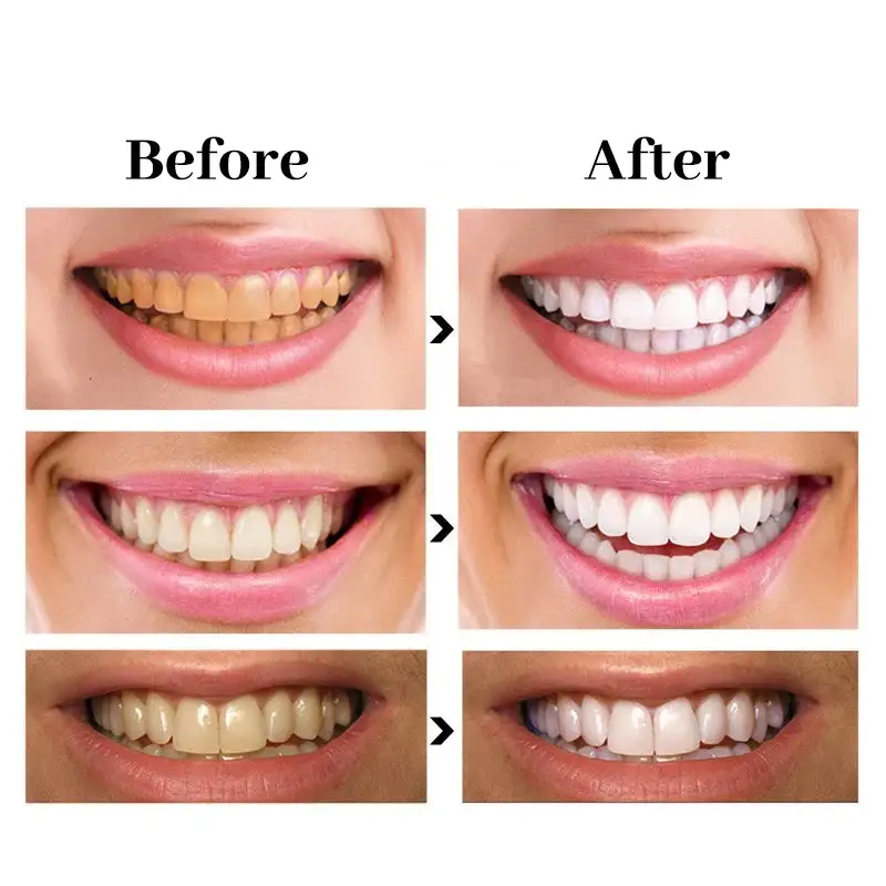 Newyuo™ Triple Whitening Toothpaste, Brightening & Stain Removal & Freshening Breath