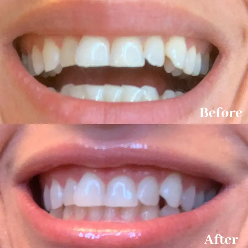 Newyuo™ Triple Whitening Toothpaste, Brightening & Stain Removal & Freshening Breath