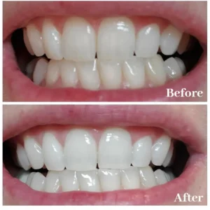 Newyuo™ Triple Whitening Toothpaste, Brightening & Stain Removal & Freshening Breath