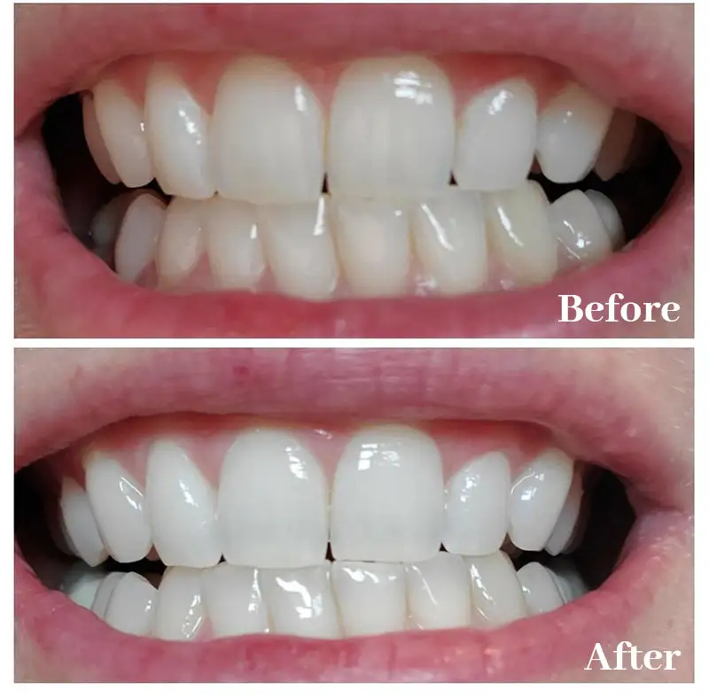 Newyuo™ Triple Whitening Toothpaste, Brightening & Stain Removal & Freshening Breath