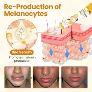 Newyuo® VitiCalm Bee Venom Cream