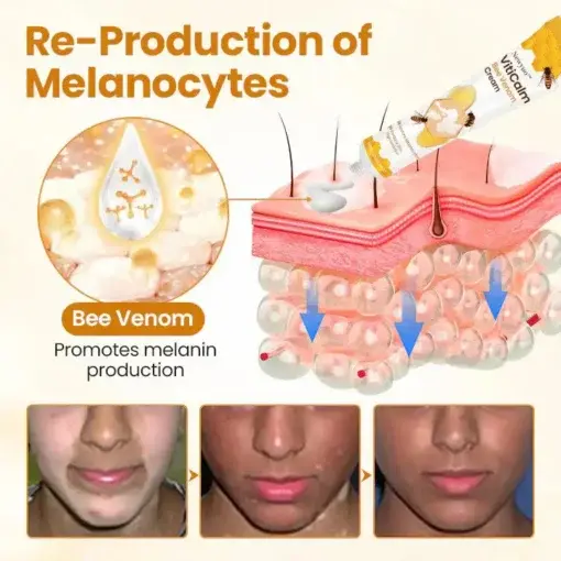 Newyuo® VitiCalm Bee Venom Cream