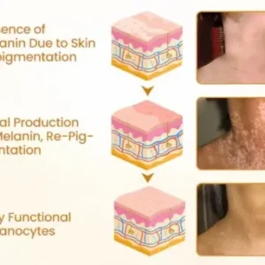 Newyuo® VitiCalm Bee Venom Cream