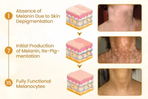 Newyuo® VitiCalm Bee Venom Cream