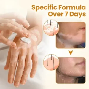 Newyuo® VitiCalm Bee Venom Cream