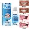 🦷 NEWYUO™ Dental Filling Gel – Pain-Free, Drill-Free Cavity Solution💖💖