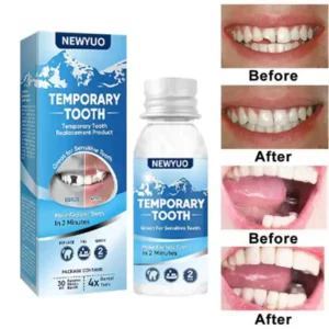 🦷 NEWYUO™ Dental Filling Gel – Pain-Free, Drill-Free Cavity Solution💖💖
