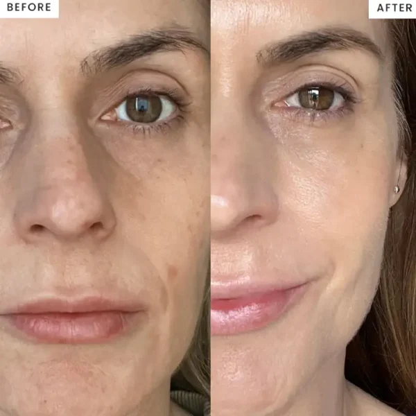 Newyuo™ Copper Peptides Serum with GHK-Cu — Visibly Reduce Wrinkles & Restore Youthful Skin