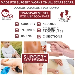 Newyuo™ Medical-Grade Silicone Scar Gel