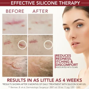 Newyuo™ Medical-Grade Silicone Scar Gel