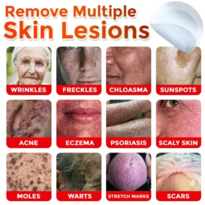 🌈Newyuo™ MicroNeedle Botanic Skin Tag Removal Patch 🇺🇸 Made in the USA