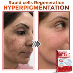 🌈Newyuo™ MicroNeedle Botanic Skin Tag Removal Patch 🇺🇸 Made in the USA