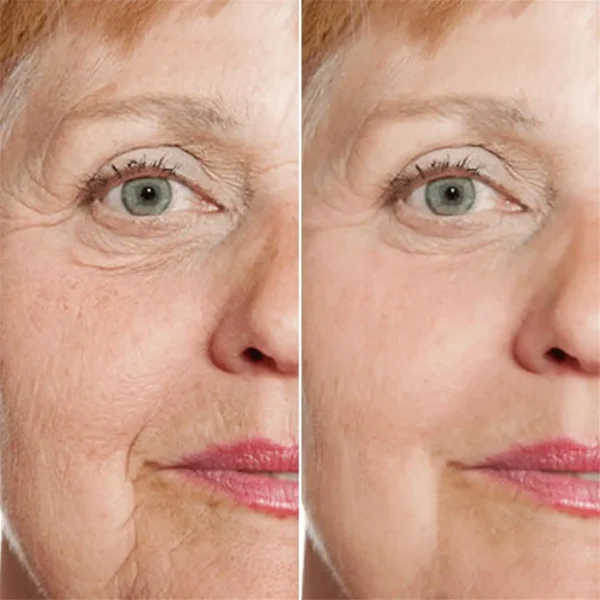 Newyuo™ Rejuvenate anti-aging serum
