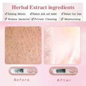 🌸 Reclaim Your Confidence with newyuo® Intimate Care Mask