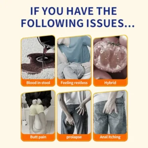 🔥LAST DAY SALE-70%ОFF✨Newyuo™ Hemorrhoid Cream – Fast Relief from Pain, Itching & Swelling