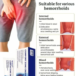 🔥LAST DAY SALE-70%ОFF✨Newyuo™ Hemorrhoid Cream – Fast Relief from Pain, Itching & Swelling