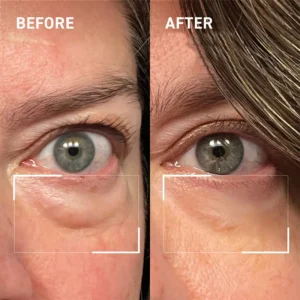 Newyuo™ Bakuchiol Eye Cream with Madagascar Centella, Anti-Aging Treatment for Wrinkles, Dark Circles & Puffiness