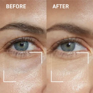 Newyuo™ Bakuchiol Eye Cream with Madagascar Centella, Anti-Aging Treatment for Wrinkles, Dark Circles & Puffiness