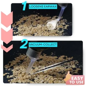 Newyuo® Electric Ear Wax Vacuum Cleaner – Safe, Quiet & Effective 👂✨