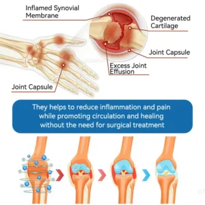 Newyuo® Joint Healing Cream🦴Treats Arthritis, Neuropathy, Rheumatism, Sports